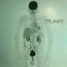 Glen Innes, NSW, Transformation, Music, Vinyl, Inertia Music, May26, Virgin, Thealarm, Rock